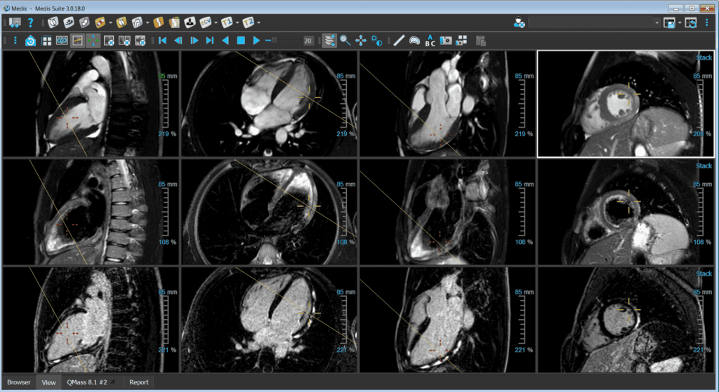 medical imaging software